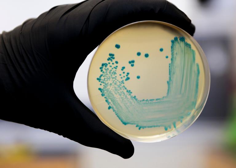 Listeria grown on agar in a petri dish.